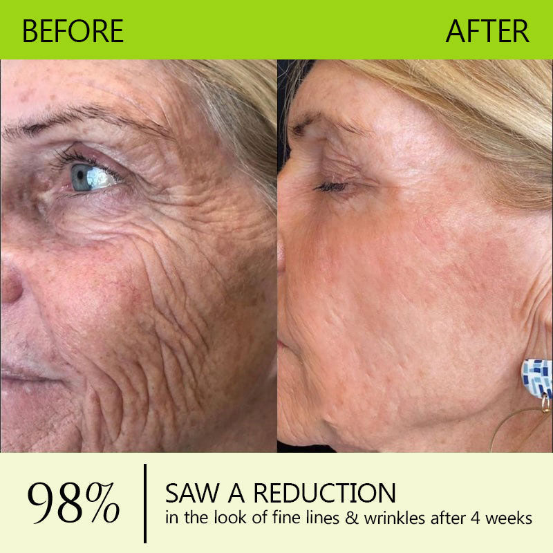 👩🏼‍⚕️ Hudros® Botox & Vita-A Retinol Shot Wrinkle-Lift Tightening cream - Last Day Promotion 70% OFF
