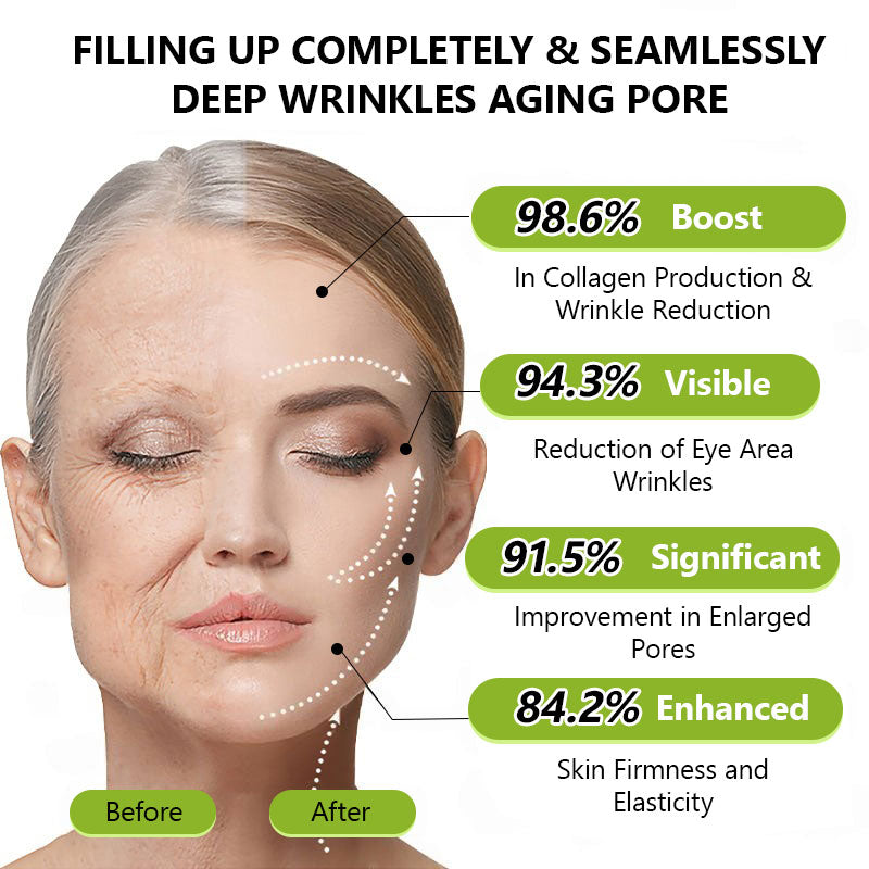 👩🏼‍⚕️ Hudros® Botox & Vita-A Retinol Shot Wrinkle-Lift Tightening cream - Last Day Promotion 70% OFF