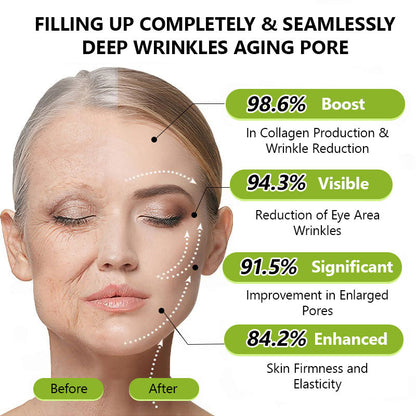 👩🏼‍⚕️ Hudros® Botox & Vita-A Retinol Shot Wrinkle-Lift Tightening cream - Last Day Promotion 70% OFF