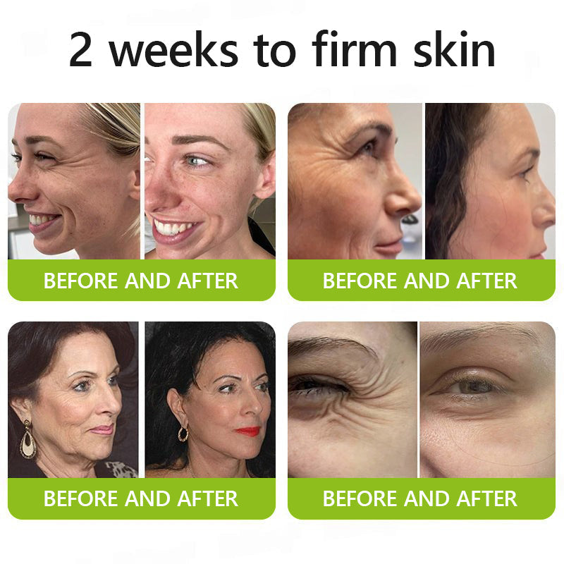 👩🏼‍⚕️ Hudros® Botox & Vita-A Retinol Shot Wrinkle-Lift Tightening cream - Last Day Promotion 70% OFF