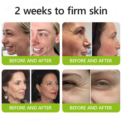 👩🏼‍⚕️ Hudros® Botox & Vita-A Retinol Shot Wrinkle-Lift Tightening cream - Last Day Promotion 70% OFF