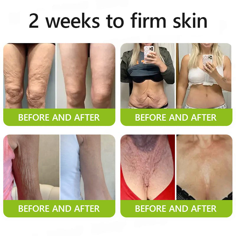 👩🏼‍⚕️ Hudros® Botox & Vita-A Retinol Shot Wrinkle-Lift Tightening cream - Last Day Promotion 70% OFF