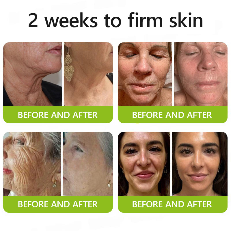 👩🏼‍⚕️ Hudros® Botox & Vita-A Retinol Shot Wrinkle-Lift Tightening cream - Last Day Promotion 70% OFF
