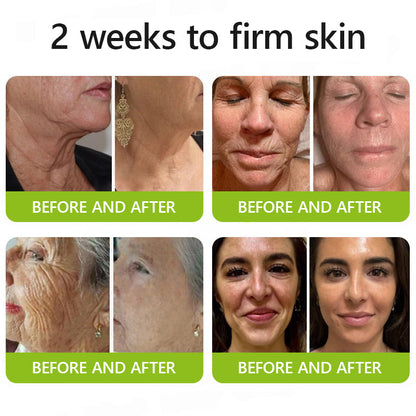 👩🏼‍⚕️ Hudros® Botox & Vita-A Retinol Shot Wrinkle-Lift Tightening cream - Last Day Promotion 70% OFF